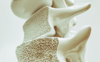 Why do I need take care of my bones as I age? What is osteoporosis?