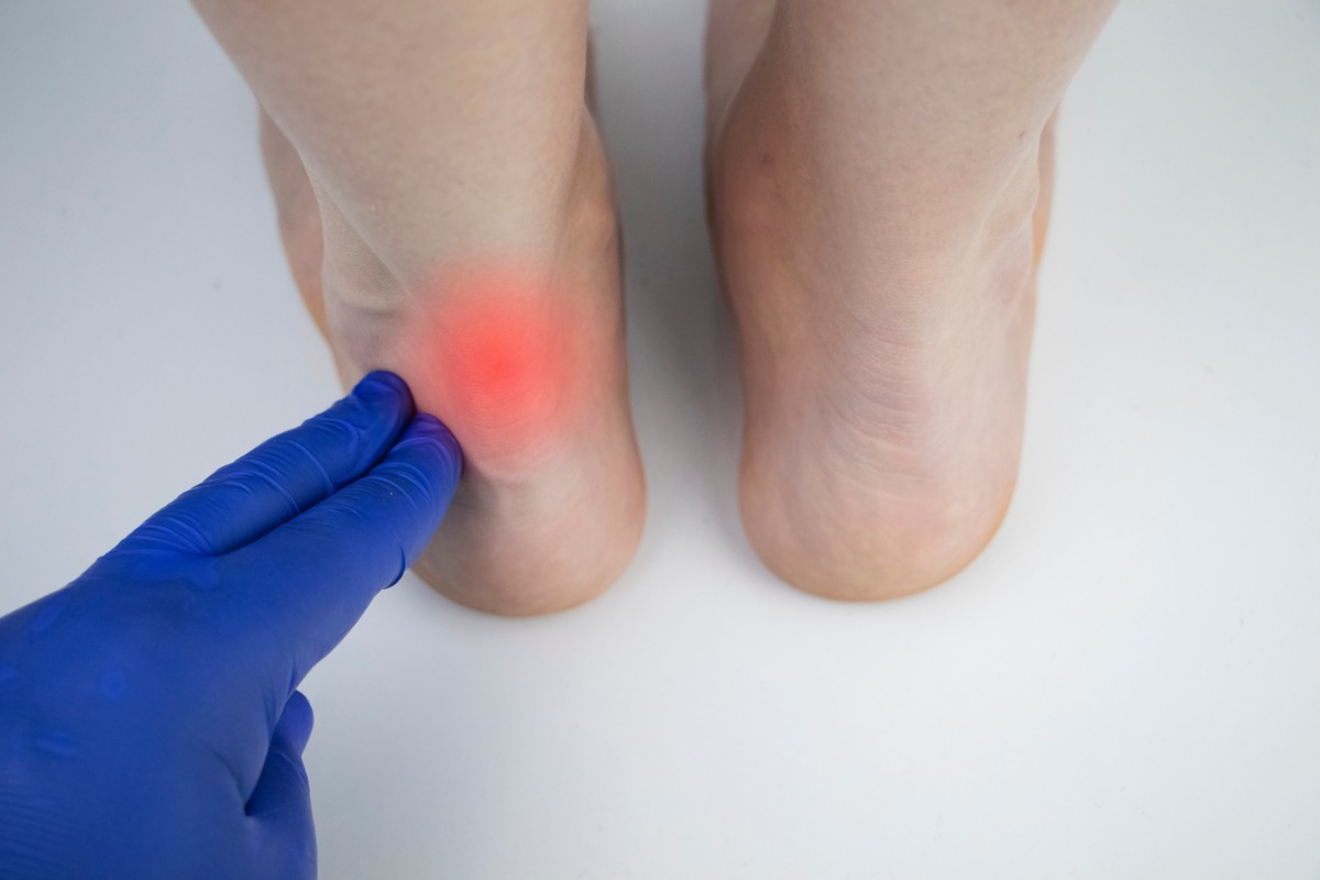achilles heel pain achilles heel pain