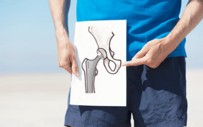 Anterior Lateral Hip Replacement Surgery at OSMC