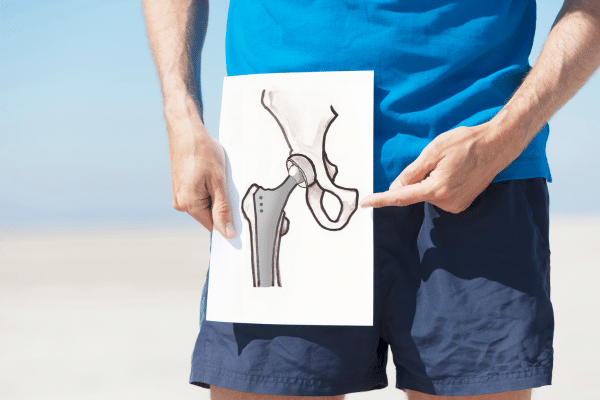 Anterior Lateral Hip Replacement Surgery – OSMC Anterior Lateral Hip Replacement Surgery - OSMC