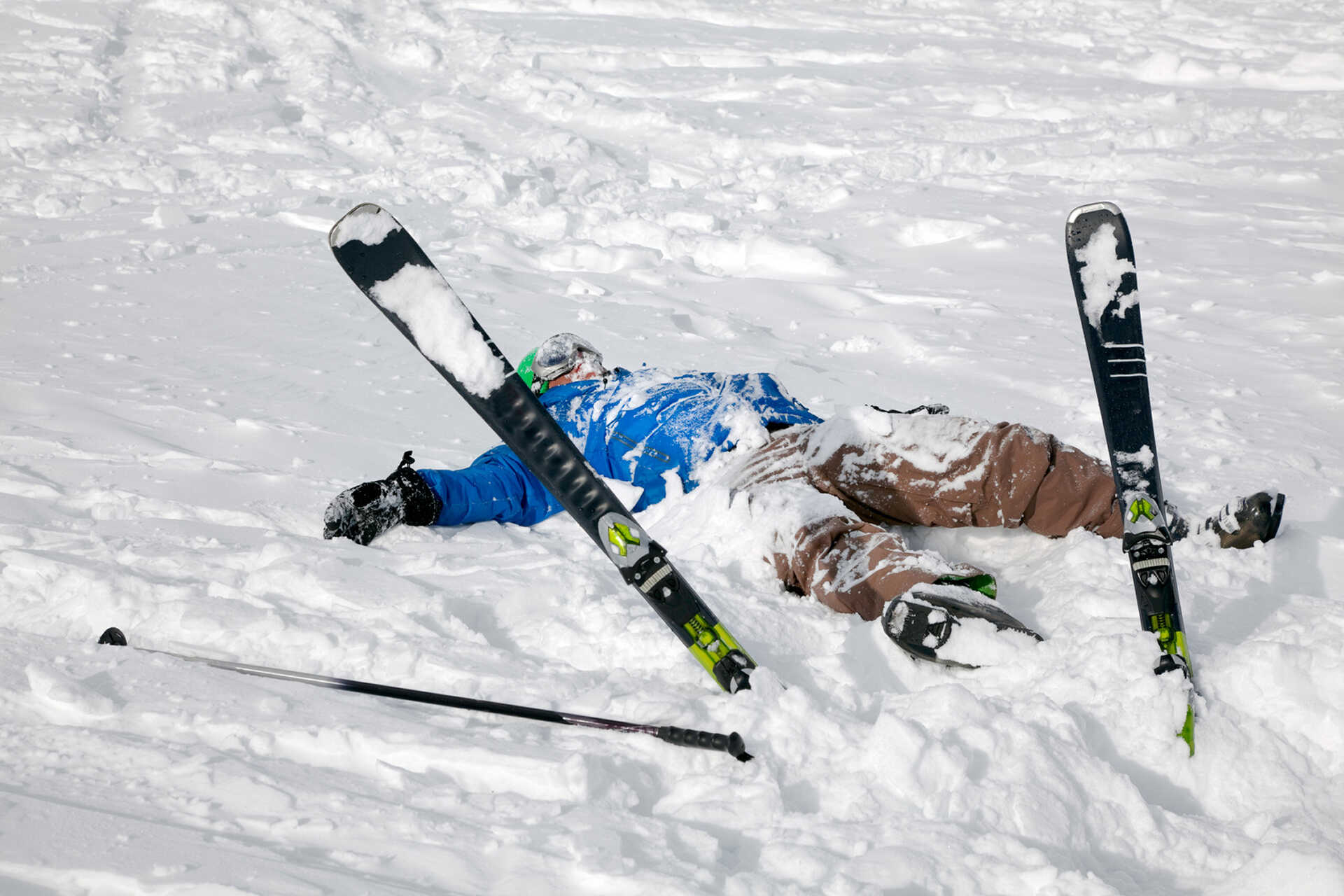 Skier Falling Snow Accident Image