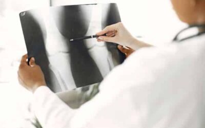 When Should You See an Orthopedic Doctor? Signs You Shouldn’t Ignore