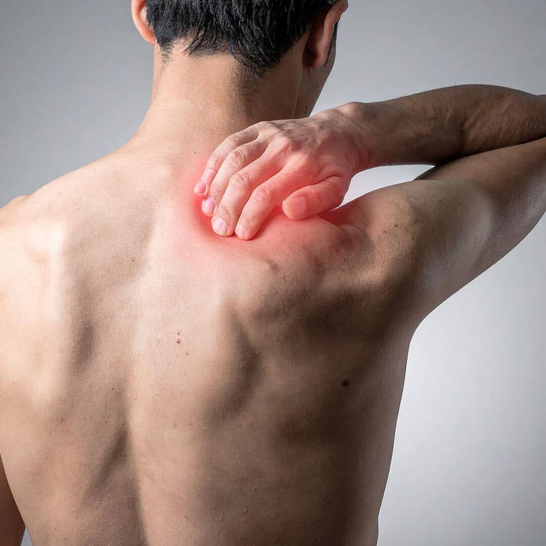 shoulder pain osmc